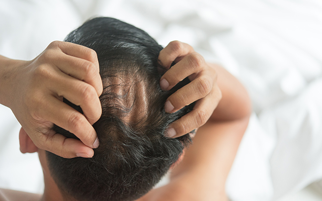 発毛効果のミノキシジルと脱毛を防ぐ薬との併用で頭頂部まで効果がでます。