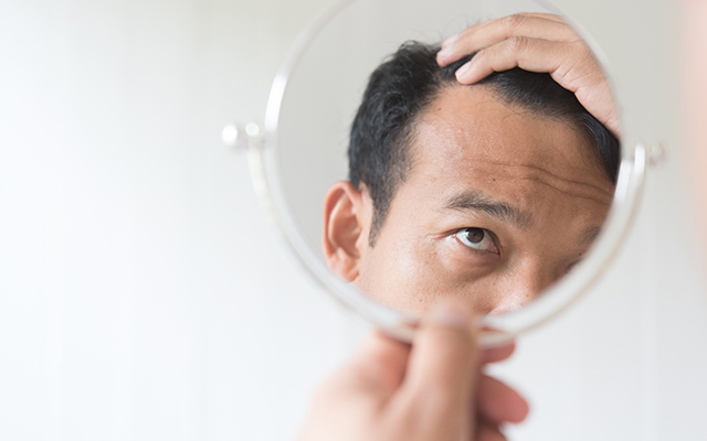 薄毛対策のためのミノキシジルは副作用として初期脱毛が起こります。