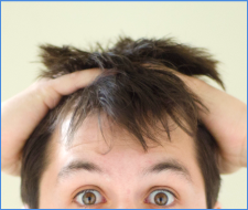 頭皮のかゆみと抜け毛の原因と対策、頭皮と髪の健康を維持する方法