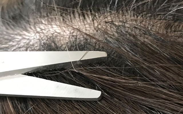 白髪は抜くと薄毛になりますが、根本から切ればまた生えてきます。
