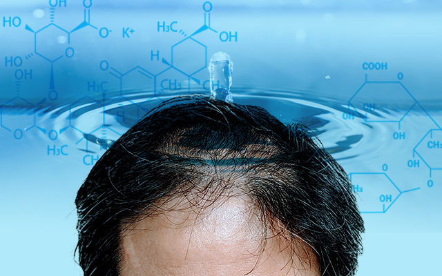 育毛剤にはかゆみや炎症を防ぎ頭皮環境を良くする効果もあります。