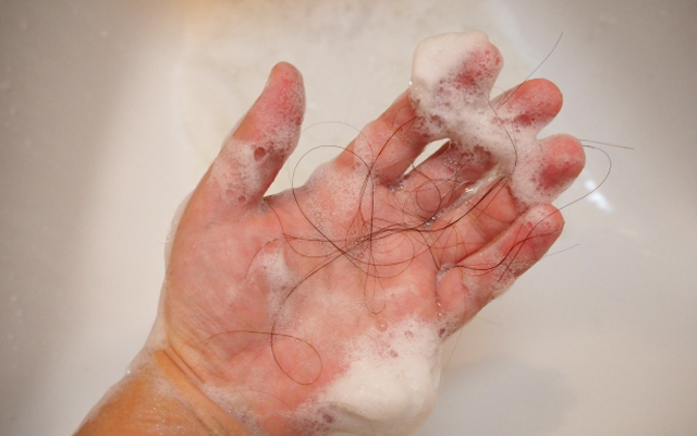 発毛サイクルが乱れ抜け毛が増える原因は自分にあっていないシャンプーやサプリメントを使っていることです。