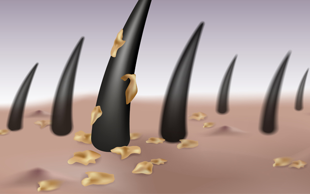 発毛サイクルが乱れ、抜け毛を引き起こす原因は洗髪で汚れを落とせてないことにあります。